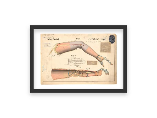 Artificial Arm Patent Print 1865 - Medical Decor, Prosthetic History Art, Vintage Anatomy Poster, Antique Medical Office Art