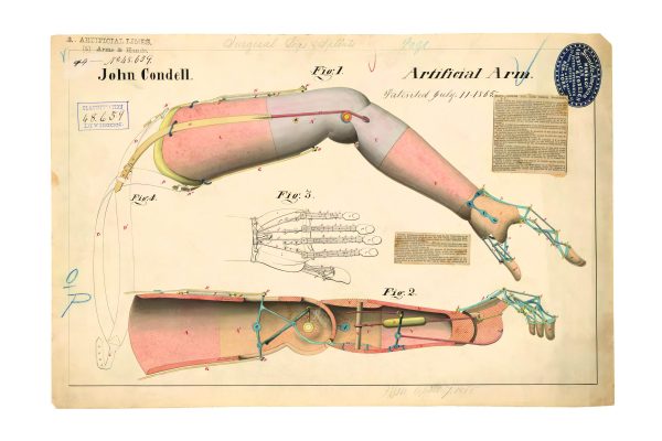 Artificial Arm Patent Print 1865 - Medical Decor, Prosthetic History Art, Vintage Anatomy Poster, Antique Medical Office Art